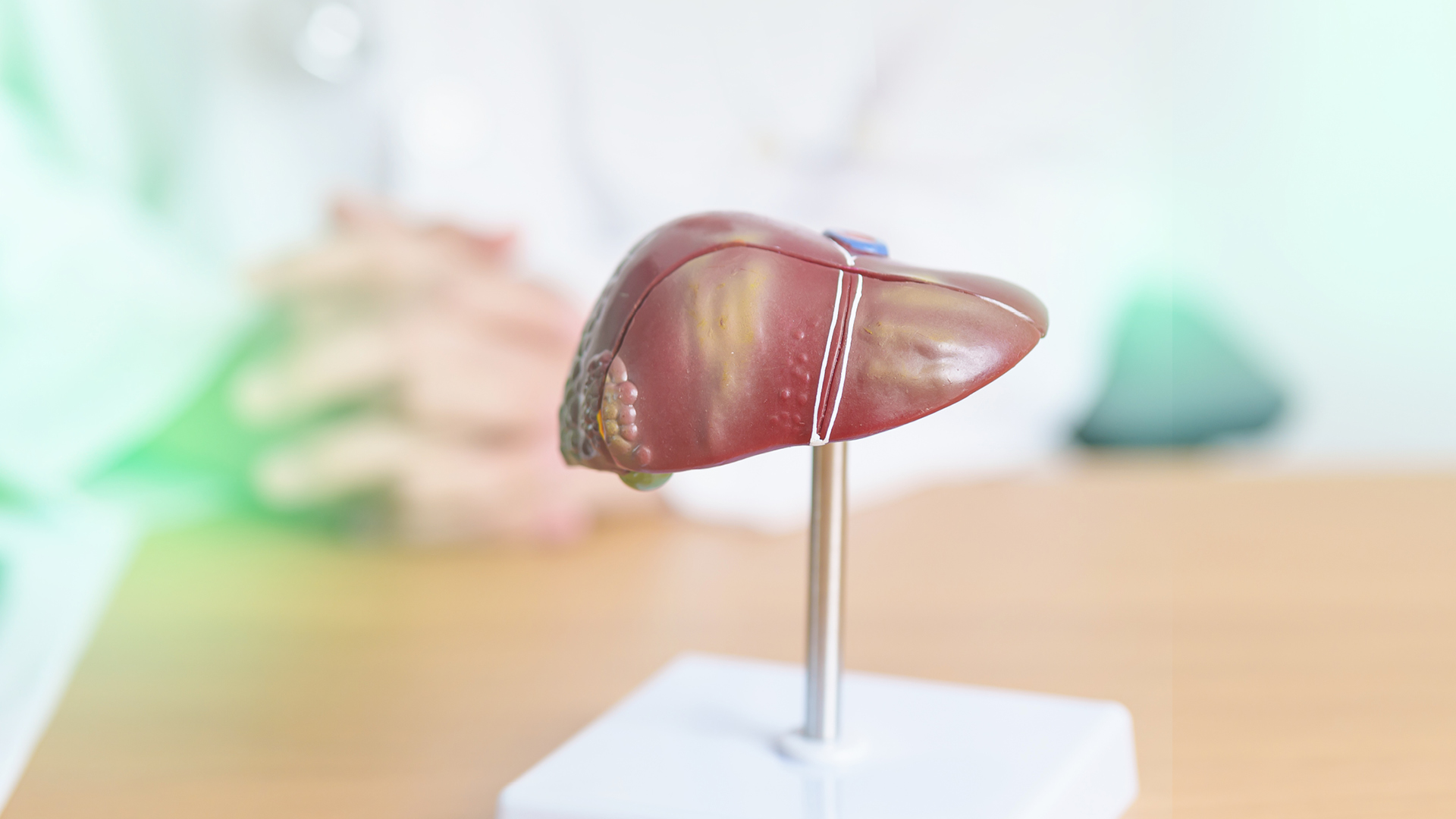 Modell einer Fettleber auf einem Tisch