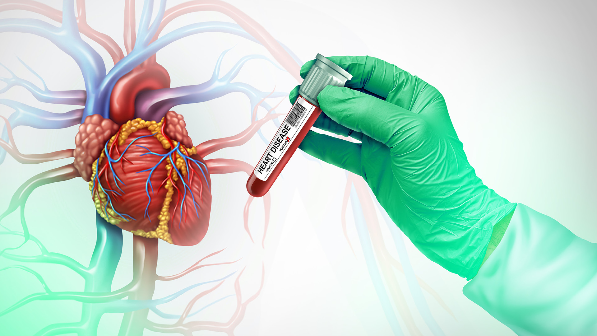 Organ Herz, Hand mit Schutzhandschuh hält eine Blutprobe