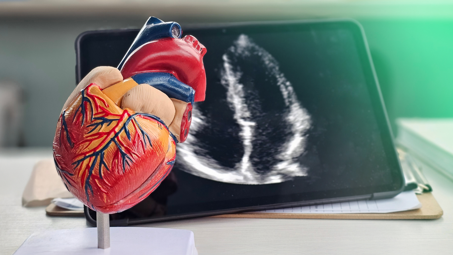 Herzmodell neben Echokardiografie-Bild