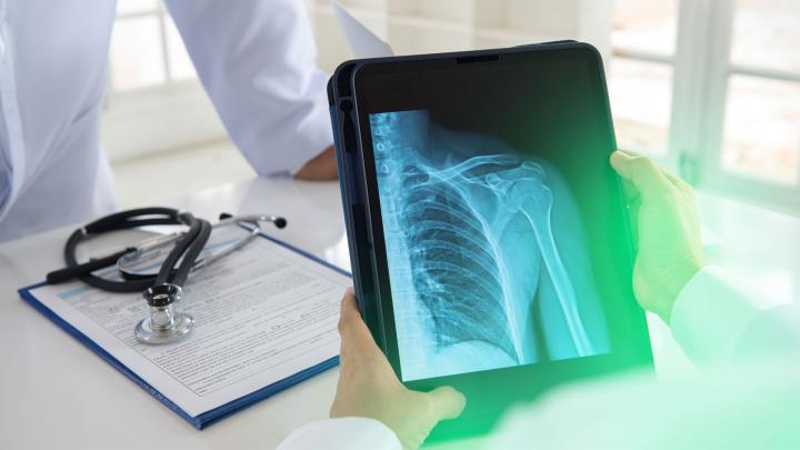 Gespräch unter Ärzten basierend auf einer Röntgenaufnahme auf einem Tablet