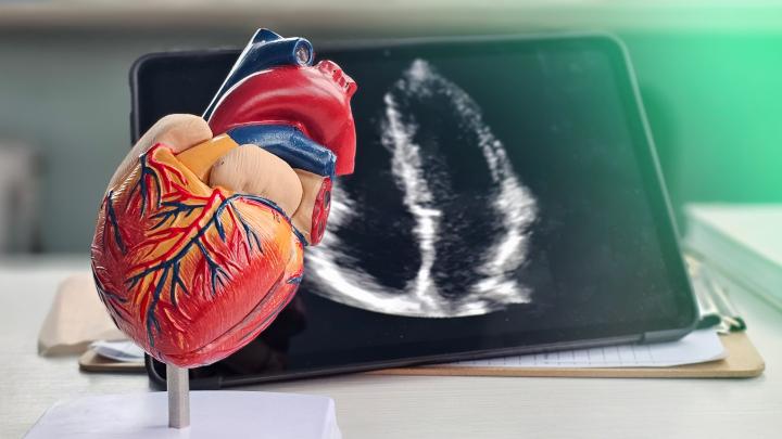 Herzmodell neben Echokardiografie-Bild