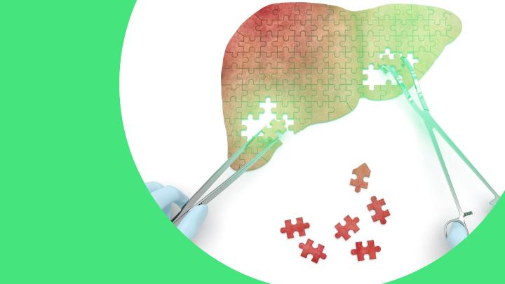 Illustration einer Leber aus Puzzleteilen, die von zwei ärztlichen Händen mit Instrumenten zusammengesetzt wird – symbolische Darstellung von Diagnose und Therapie bei Fettleber und MASH.